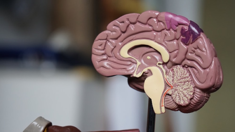 Anatomical model of the human brain used in stroke education